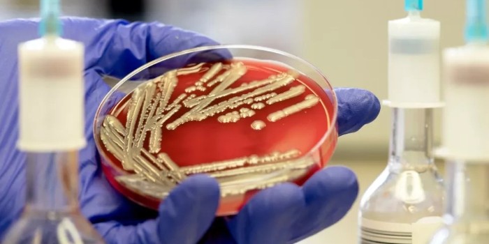 实验室培养皿研究表明，抗抑郁药可能助长超级细菌的兴起