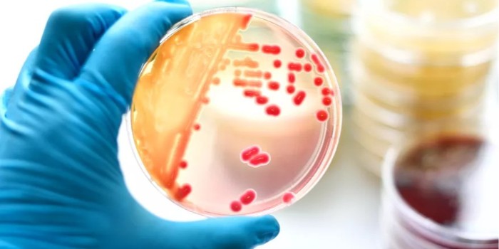 培养皿：微生物学与细胞学中的利器