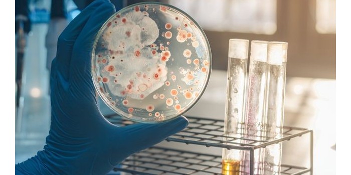 细菌培养测试